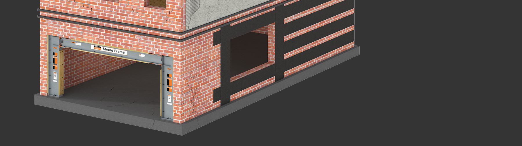 sol-urm-veneerbracingpinning-hero1.jpg